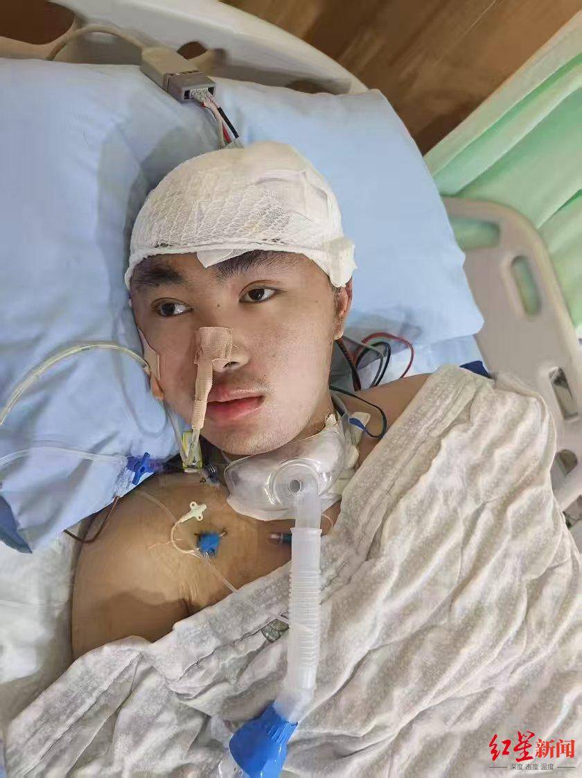 “23歲研究生被少年無證駕車撞成重傷後心智如幼童”追蹤：法院為其申請司法救助