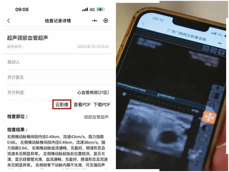 便民新舉措，就診無需實體膠片——廣安門醫院全面推行電子影像服務